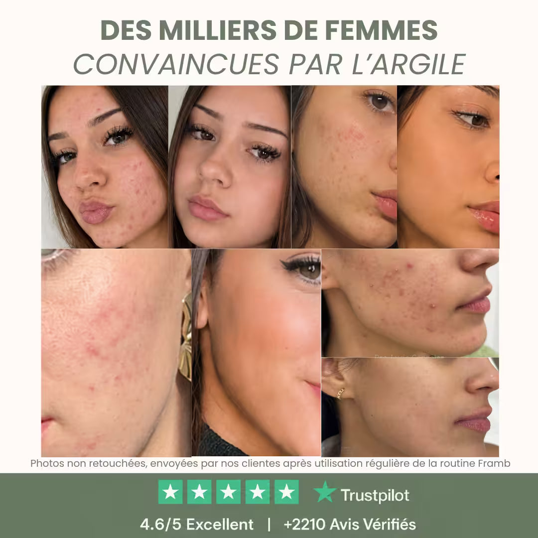 Routine Anti-Imperfections