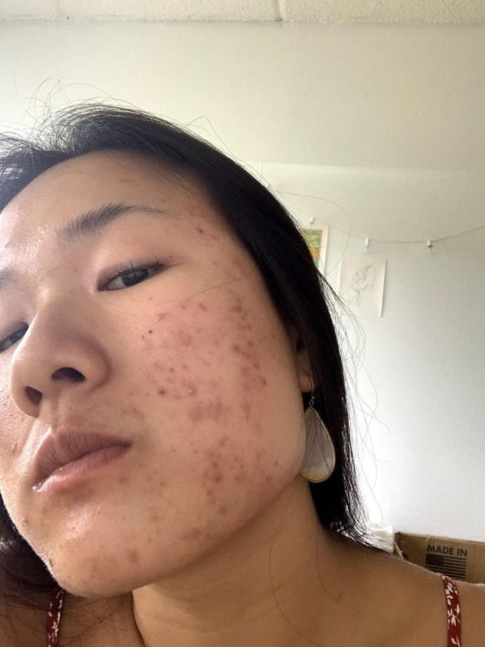 Visage avec imperfections, avant