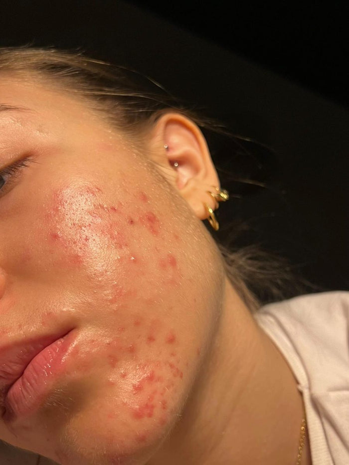 Visage avec imperfections, avant