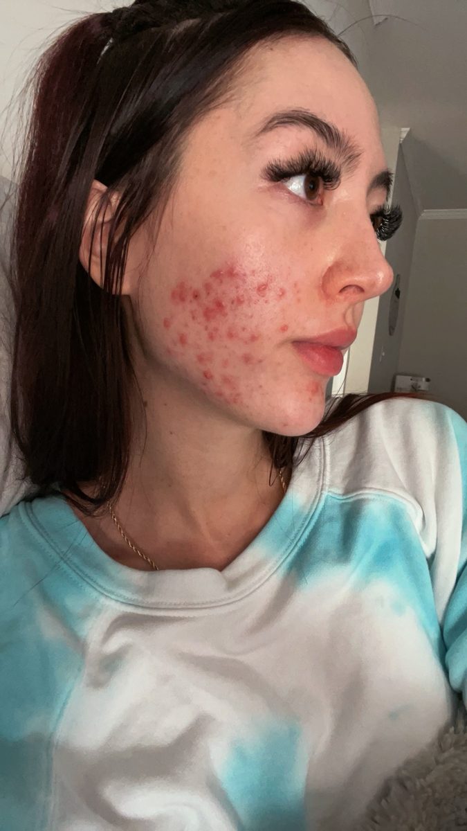 Visage avec imperfections, avant