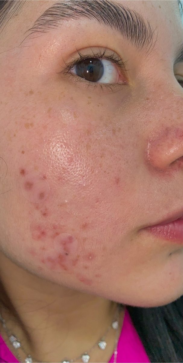 Visage avec imperfections, avant