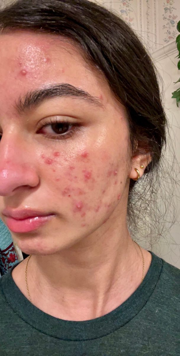 Visage avec imperfections, avant