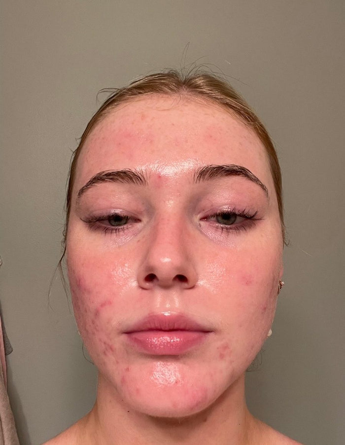 Visage avec imperfections, avant