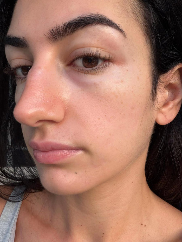Le même visage, après