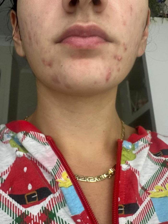 Visage avec imperfections, avant