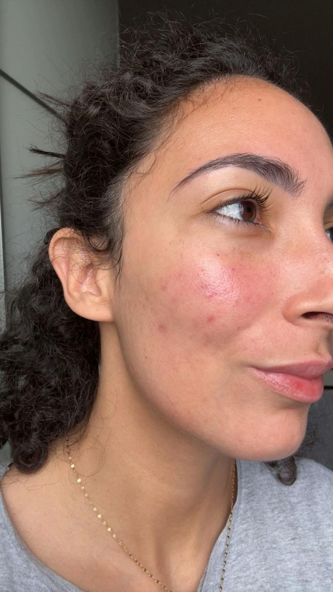Le même visage, après