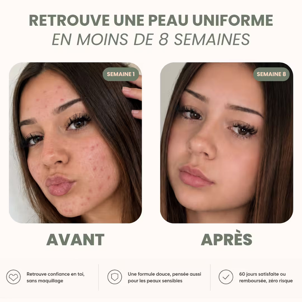 Routine Anti-Imperfections