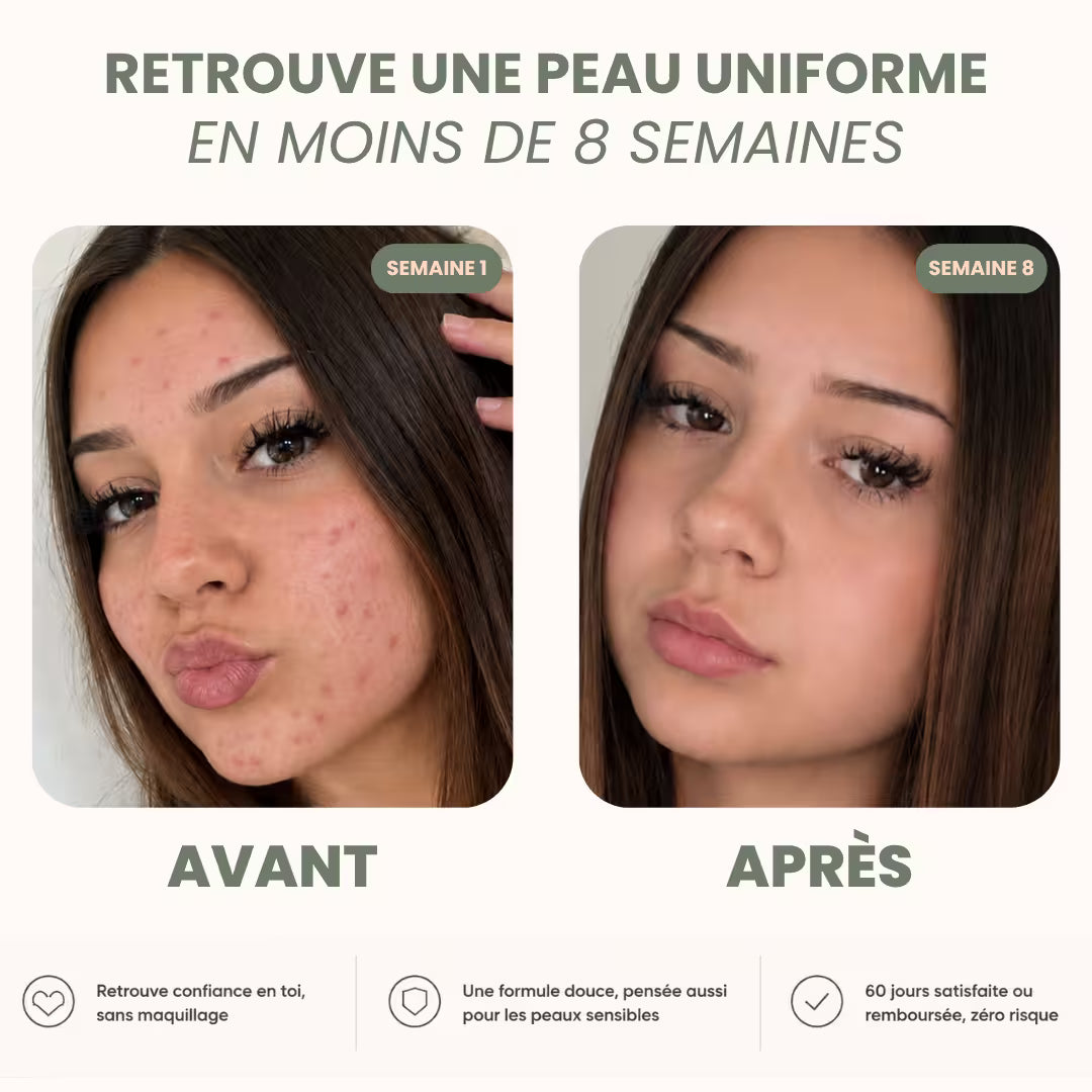 Routine Anti-Imperfections