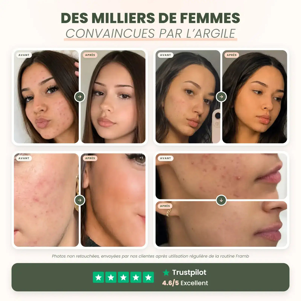 Avant / après de 4 clientes avec le masque à l'argile Framb