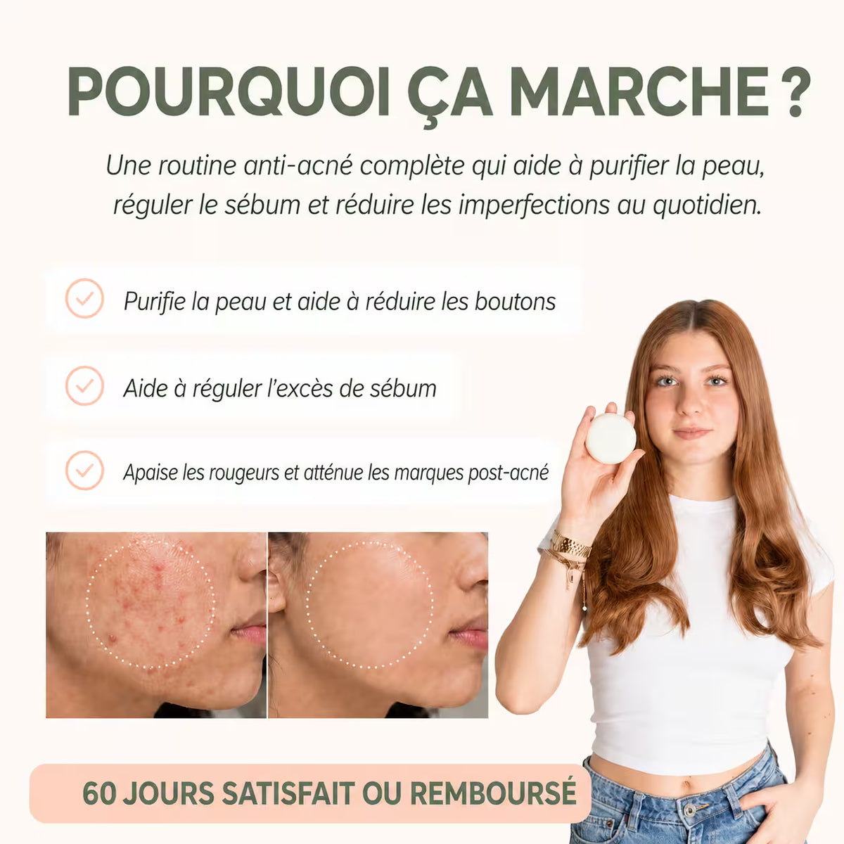 Routine Anti-Imperfections
